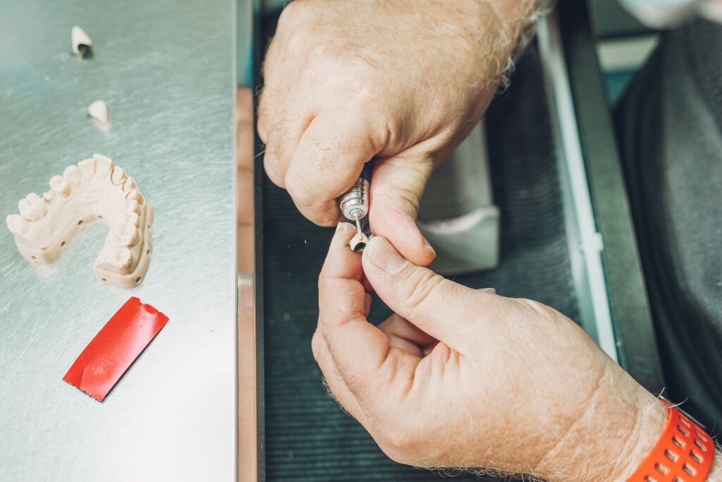 Protesi Dentali Mobili a Iseo