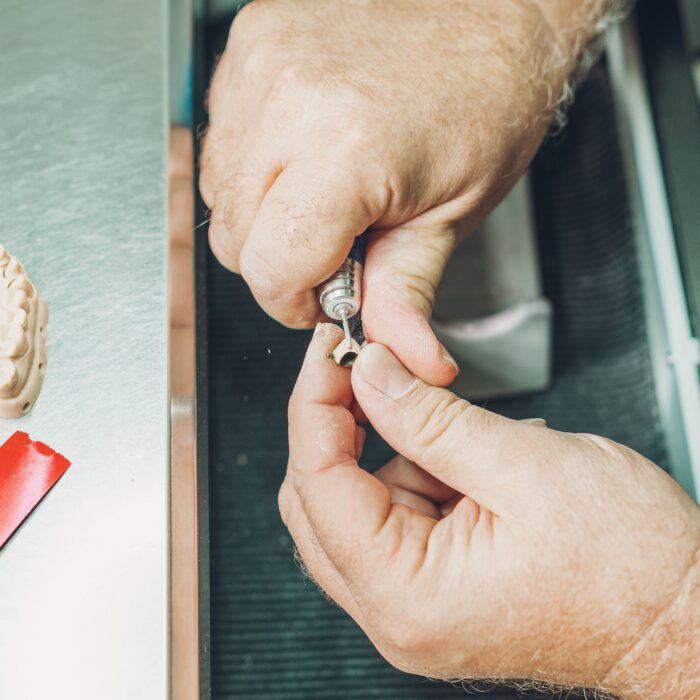 Protesi Dentali Mobili a Iseo