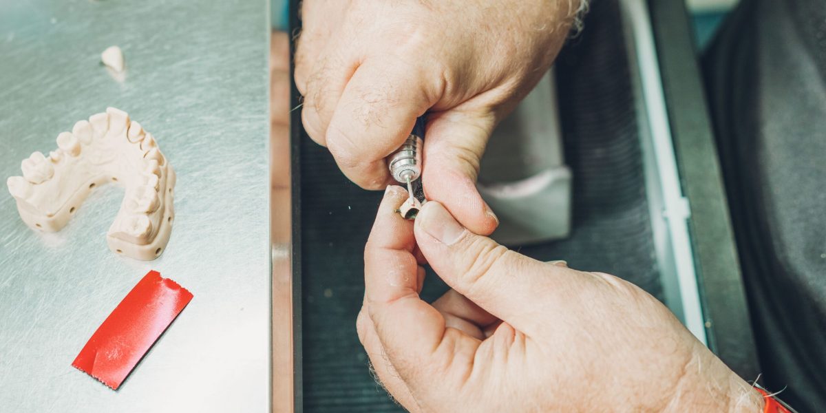 Protesi Dentali Mobili a Iseo